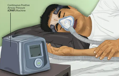 cpap machine user sleeping with mask and headgear, machine displaying 6.0 cmh2o pressure setting for sleep apnea management