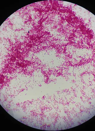 gram-stained microscopic view of lactobacillus bacteria, showing characteristic rod-shaped morphology in a field of view
