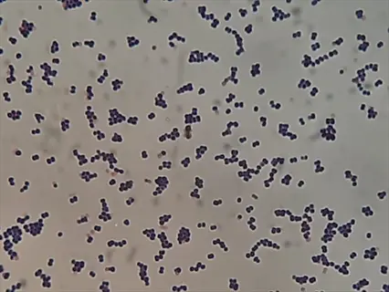 gram-stained microscopic view of leuconostoc mesenteroides bacteria showing spherical cocci in clusters with dark purple staining