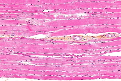 h&e stain of longitudinal-sectioned skeletal muscle tissue showing striations, myonuclei (dark spots), and connective tissue (pink bands). illustrates healthy muscle histology