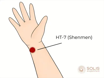 illustration of a human wrist highlighting the ht-7 shenmen acupoint with a red marker and label 'ht-7 (shenmen)', created by solis acupuncture