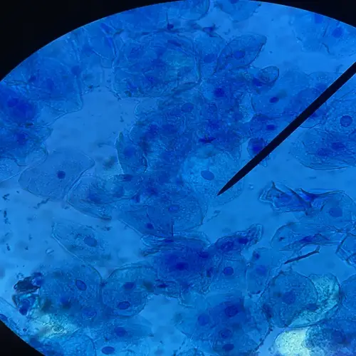 microscopic view of human cells with blue-stained nuclei and cytoplasm, captured under a light microscope