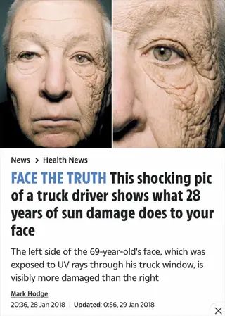 news article screenshot showing truck driver's face comparison demonstrating 28 years of sunlight on skin damage (left side exposed to uv through window)