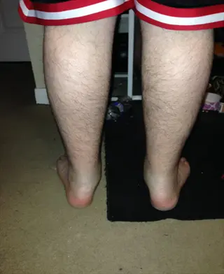 rear view of person standing barefoot on carpet showing foot arch standing position, with visible legs, ankles, and red-white striped shorts