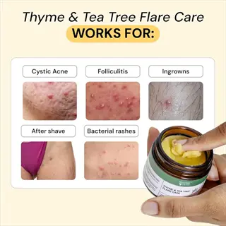 thyme & tea tree flare care product for acne and skin conditions (infographic showing application on cystic acne, folliculitis, etc. with hand scooping cream)