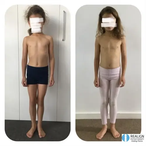 two children demonstrating correct standing posture, faces obscured, with realign physiotherapy logo at bottom right